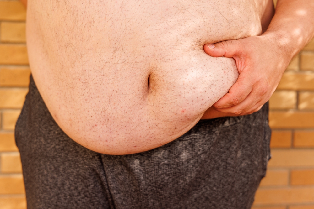 10 Dikste mensen die ooit hebben geleefd